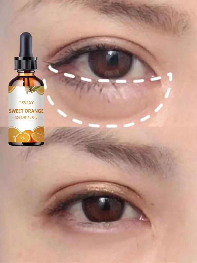 Effective Natural Eye Oil to Reduce Dark Circles and Soothe Puffiness
