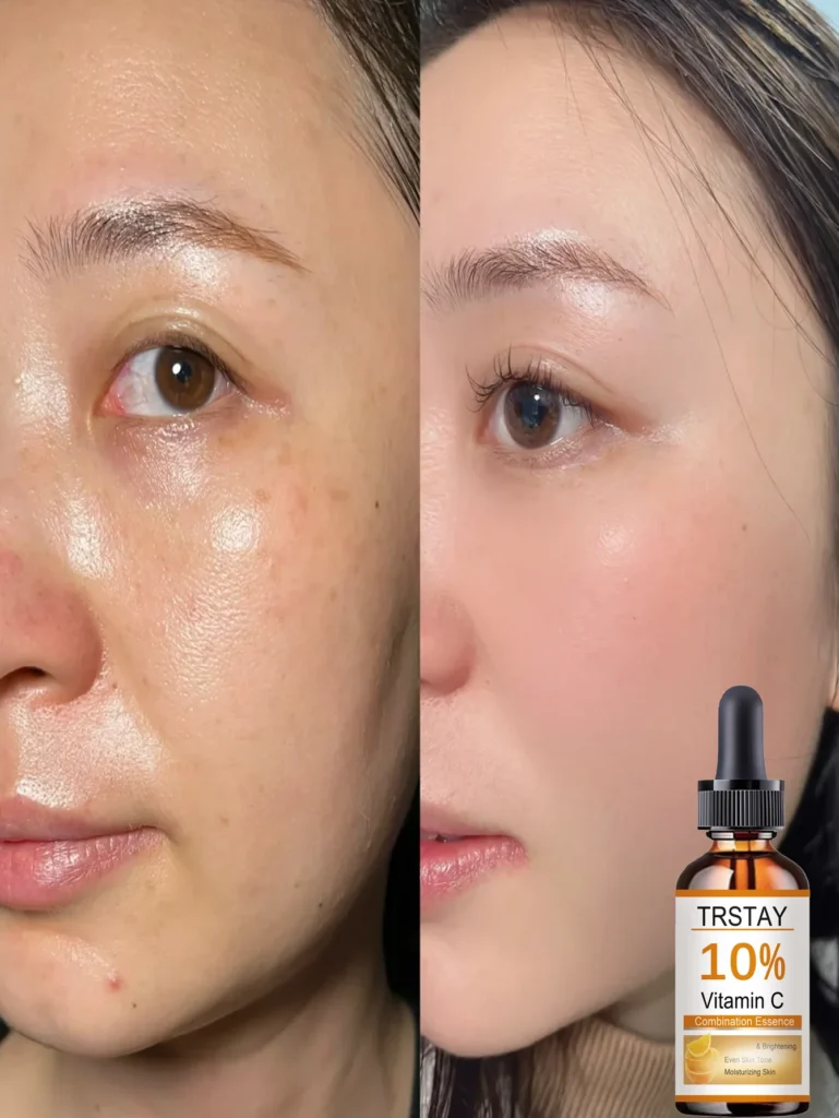 Top Hydrating Facial Oil Review for Sensitive Skin That Boosts Radiance Naturally